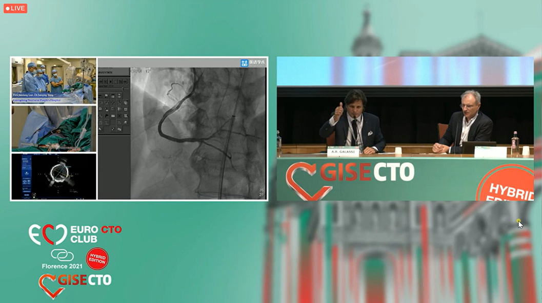 APT Medical at EuroCTO & CISE 2021 - 13th Experts live CTO