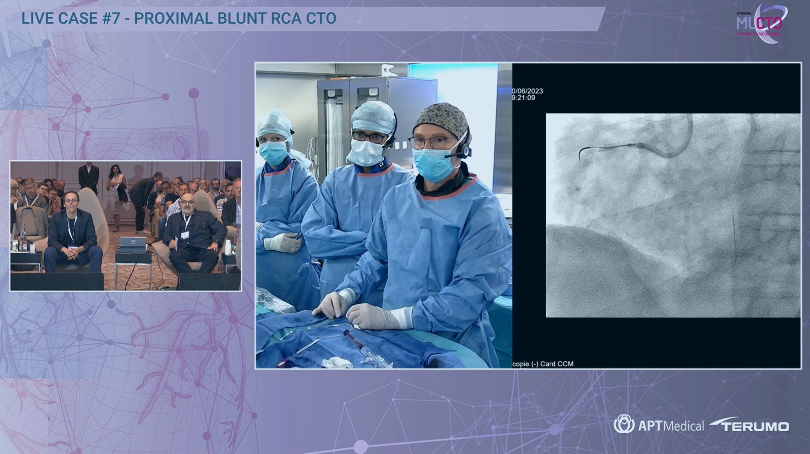 Proximal Blunt RCA CTO - MLCTO 2023 LIVE CASE