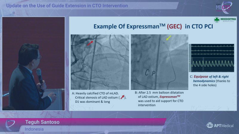 Be More Resourceful for Symphony of Complex PCI - MLCTO 2023 Pre-course Meeting